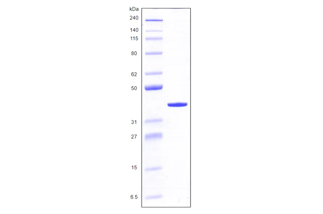 Recombinant Human Galectin 8, variant 1, His Tag (317 a.a.) -100 ug